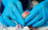 Новорожденного со сложным пороком прооперировали карагандинские медики