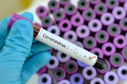 Система экспресс-диагностики коронавируса разработана в Национальном центре биотехнологии