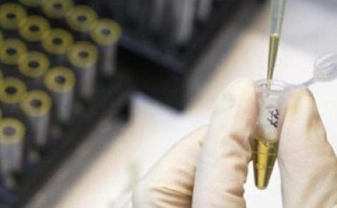 Качество использовавшейся в Карагандинской области вакцины против сибирской язвы проверят европейские специалисты