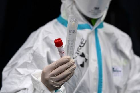 Зарегистрированы еще 11 случаев заражения коронавирусной инфекцией