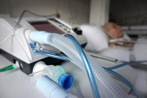 Достаточно ли в Казахстане аппаратов искусственной вентиляции легких