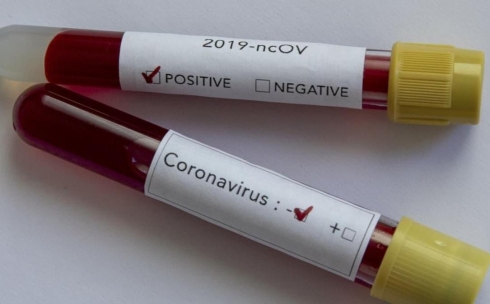 От коронавируса в Карагандинской области выздоровели 10 человек