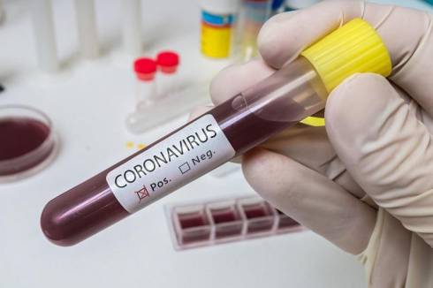 До 1591 возросло количество случаев коронавируса в Казахстане