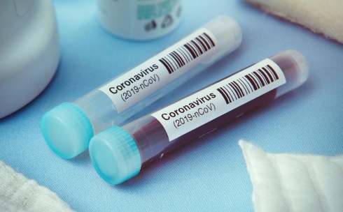 Еще 52 человека в Карагандинской области выздоровели от коронавируса