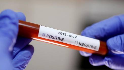 По 131 случаю коронавируса в РК проводится поиск источника заражения - Минздрав РК