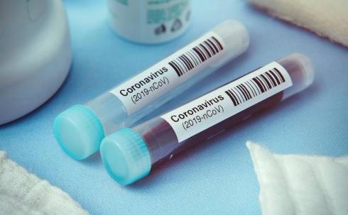 32 человека в Карагандинской области выздоровели от коронавируса