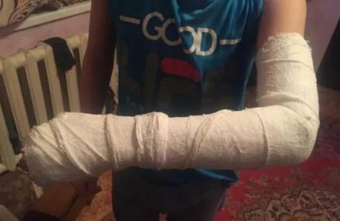 Буллинг в школе: семикласснику сломали руку в Карагандинской области