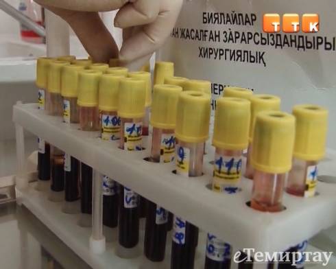 Число ВИЧ-инфицированных в Темиртау увеличилось