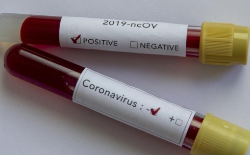 25 человек в Карагандинской области выздоровели от коронавируса