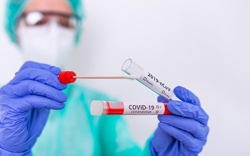 В ОЦ СПИД можно сдать анализ на ПЦР-тест на Сovid-19