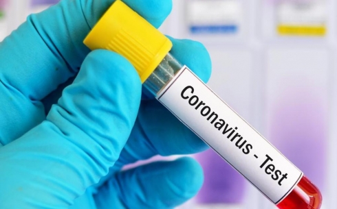 От коронавируса в Карагандинской области выздоровели 46 человек