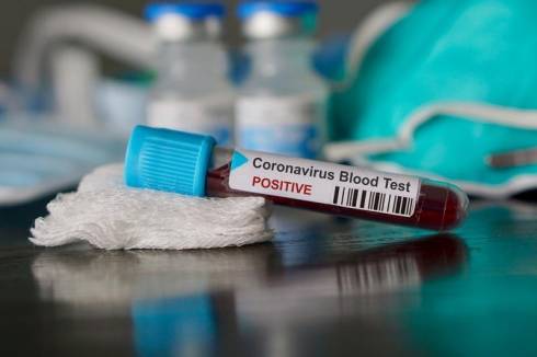 Число случаев коронавируса достигло 113: еще один заболевший в Жамбылской области