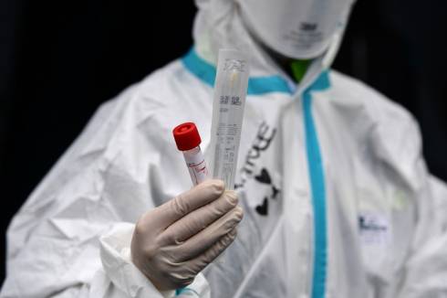 Пять новых случаев коронавируса выявили в Казахстане
