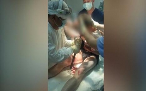 Стальная арматура вонзилась в рот парню при ДТП в Карагандинской области
