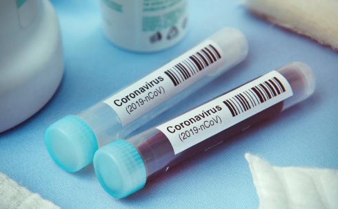 Еще 60 человек в Карагандинской области выздоровели от коронавируса