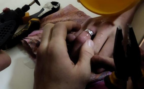 В Сарани спасатели сняли кольцо с опухшего пальца 16-летнего подростка. Видео 18+
