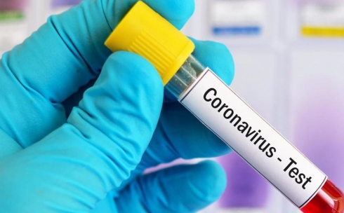Еще 57 человек в Карагандинской области выздоровели от коронавируса