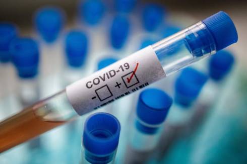 Зараженных коронавирусом в Казахстане может быть больше официальной статистики - Минздрав