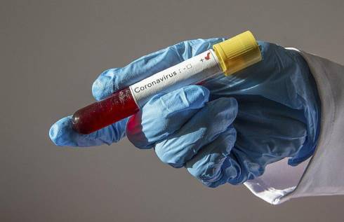18 новых случаев заболевания коронавирусом зарегистрировано в Казахстане