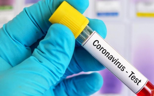 От коронавируса в Карагандинской области выздоровели 12 человек
