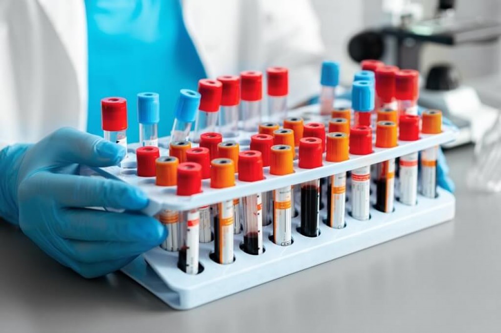 В Караганде дети с эпилепсией смогут сдавать важный анализ бесплатно