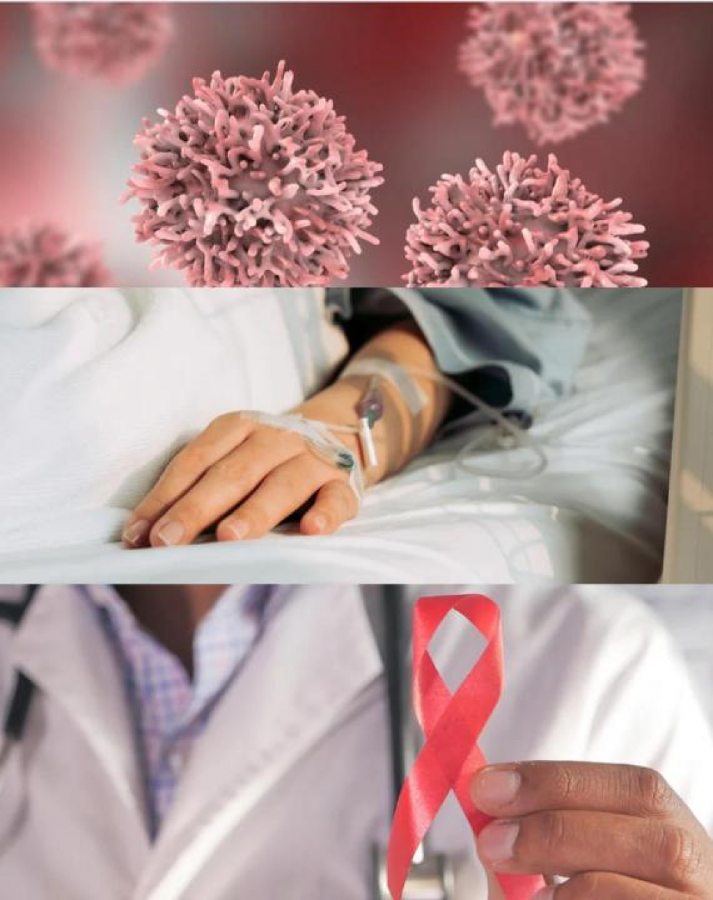 Свыше трети новых случаев онкозаболеваний в РК выявлены на ранних стадиях