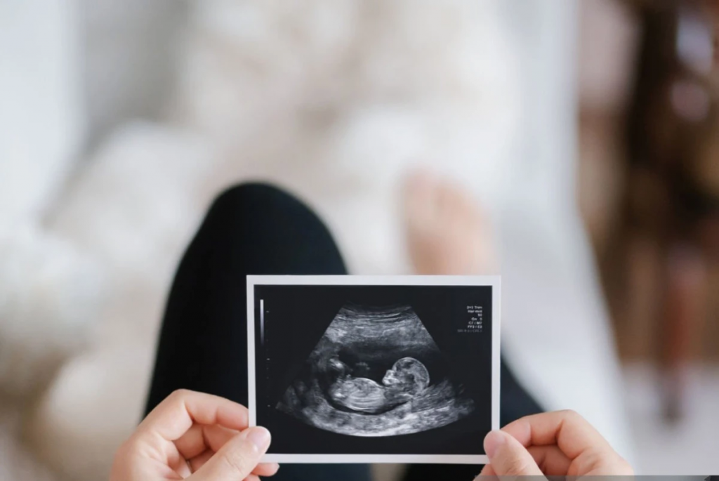 В Казахстане наблюдается взрывной рост женского бесплодия