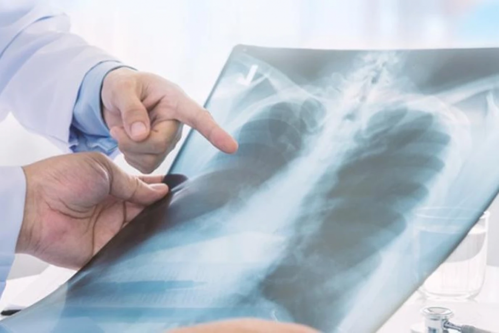 В Казахстане растёт онкозаболеваемость