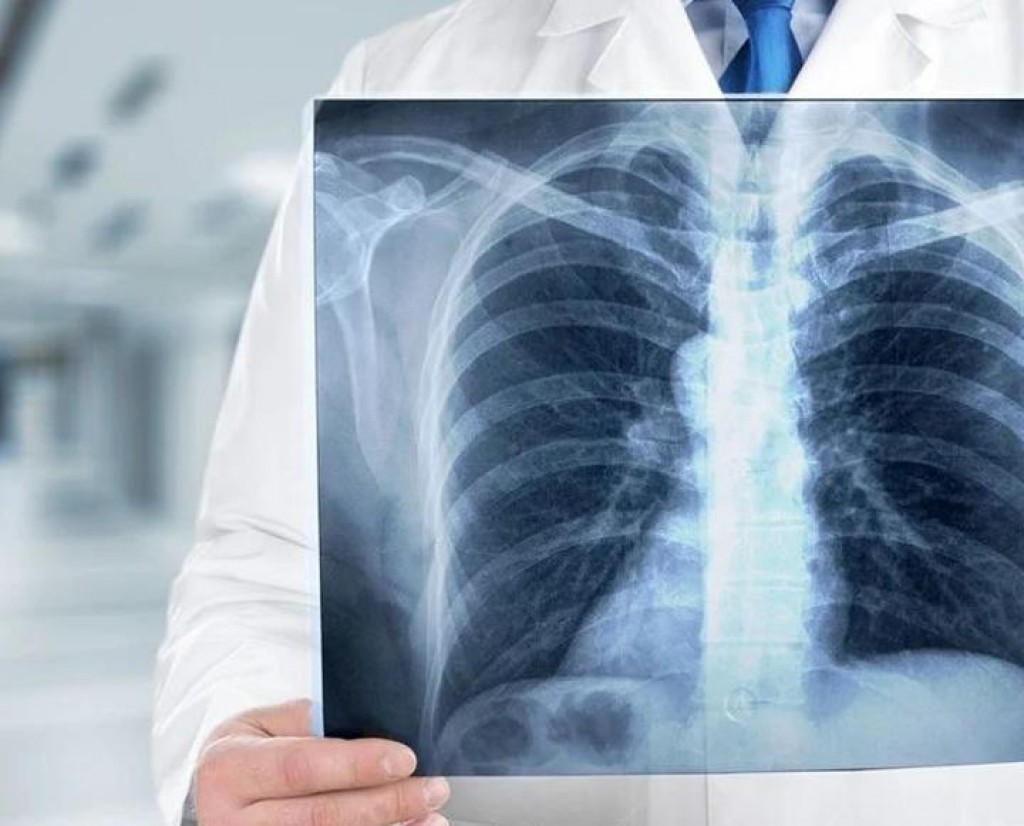 Передвижные установки: Пройти бесплатно флюорографию предлагают жителям Караганды и Темиртау