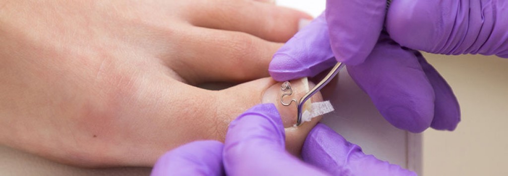 Подологи, трихологи, косметологи - к кому из этих специалистов можно попасть на бесплатный прием в поликлинике?