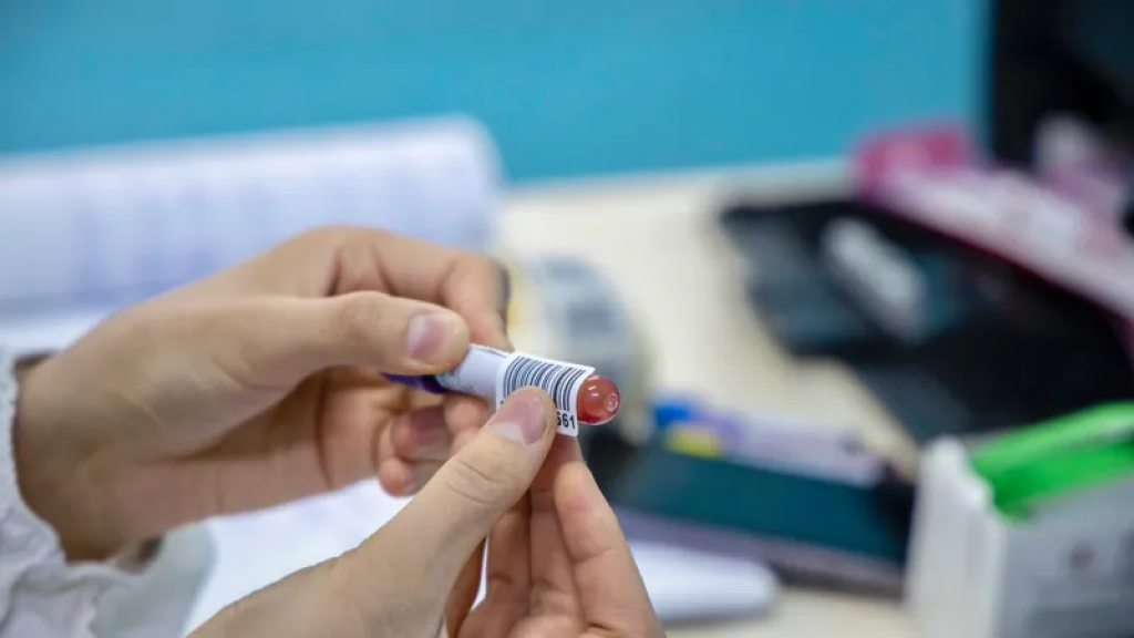 Стандарт организации оказания аллергологической и иммунологической помощи разработали в РК