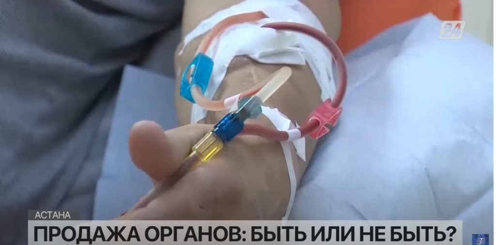 Продажа органов: «быть или не быть?»