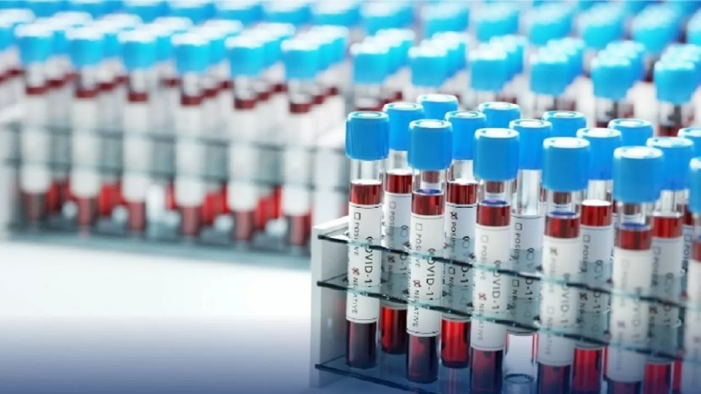 Сколько людей живут с ВИЧ в Казахстане и где: новые данные