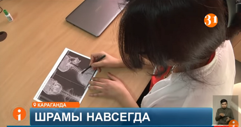 Избитая в частной клинике медсестра из Караганды вернулась к работе