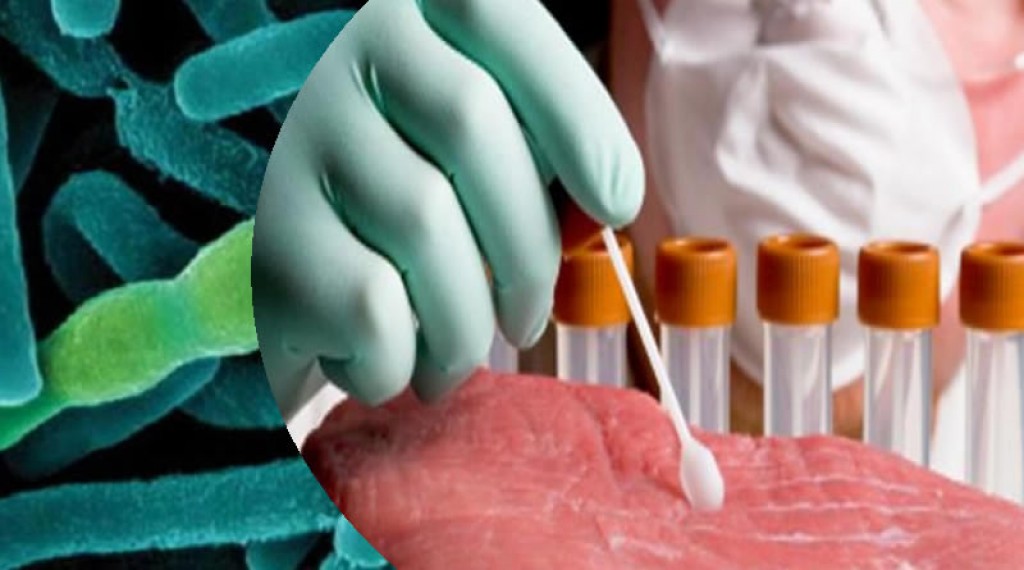 Карагандинские врачи рассказали о состоянии заболевших сибирской язвой жителей поселка Топар