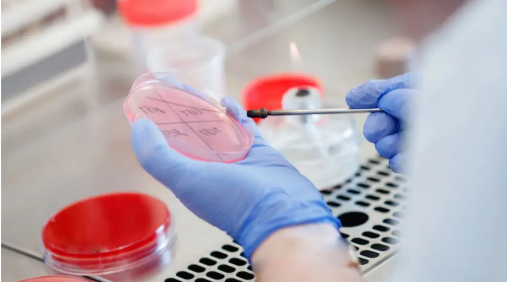 Сибирскую язву выявили в ряде регионов Казахстана