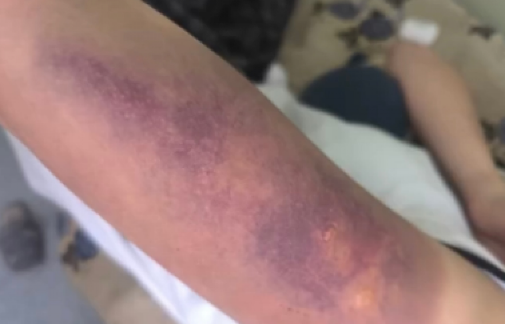 В Караганде группа подростков избила 13-летнюю девочку