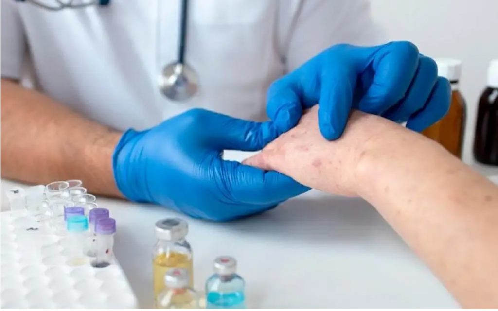 Почти 2800 казахстанцев переболели корью с начала года