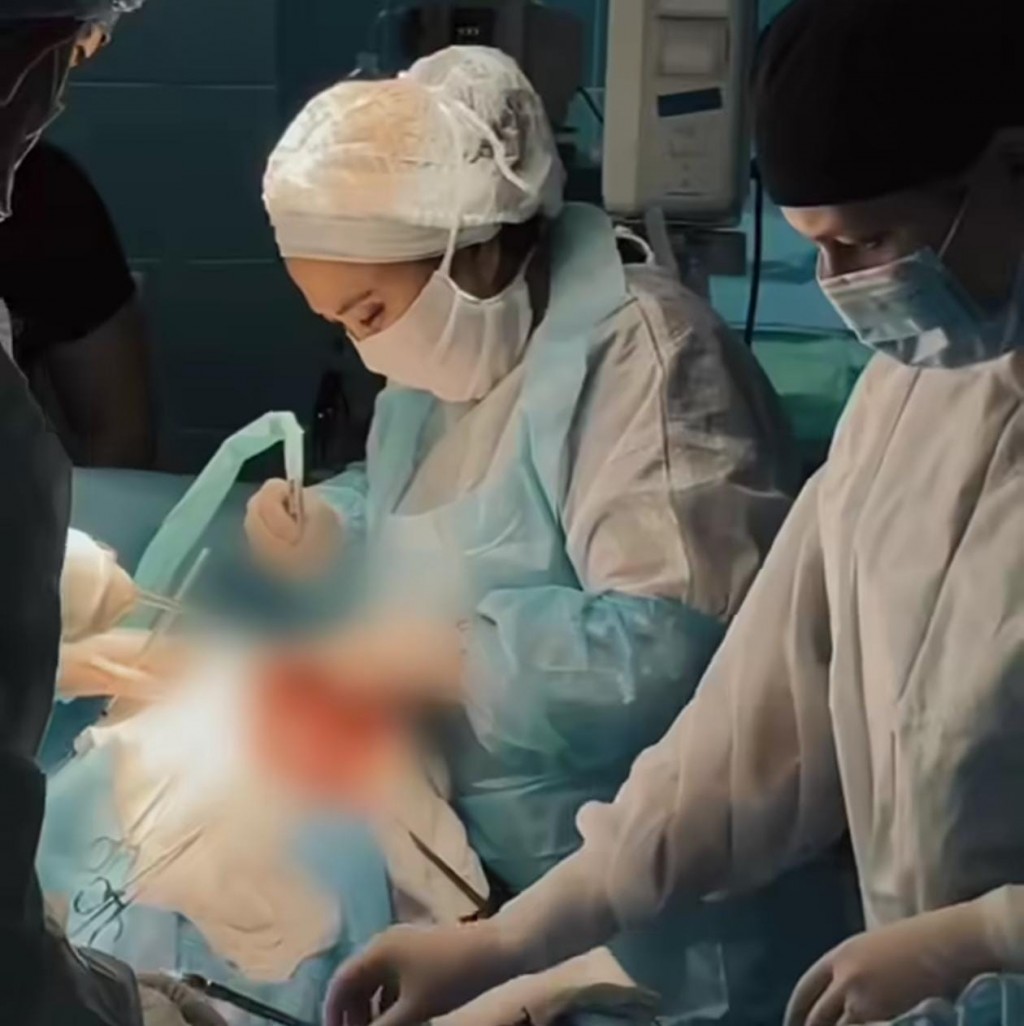 В Караганде врачи успешно удалили гигантскую кисту из живота пациентки